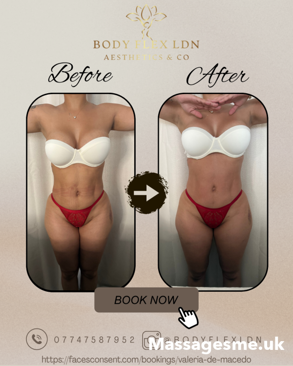 Body Flex LDN – Expert Body Sculpting & Massage Therapy In Uxbridge, West London